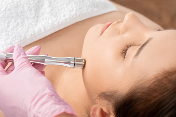 Microdermabrazyon
